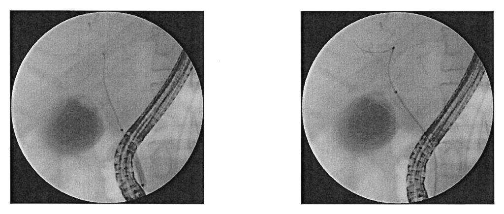 Krankenhauswahl ERCP Untersuchung Charite Bilder